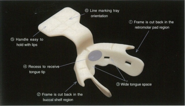 Spacing of custom trays for complete dentures